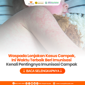 Kenali Pentingnya Imunisasi Campak dan Waktu Tepat Pemberiannya